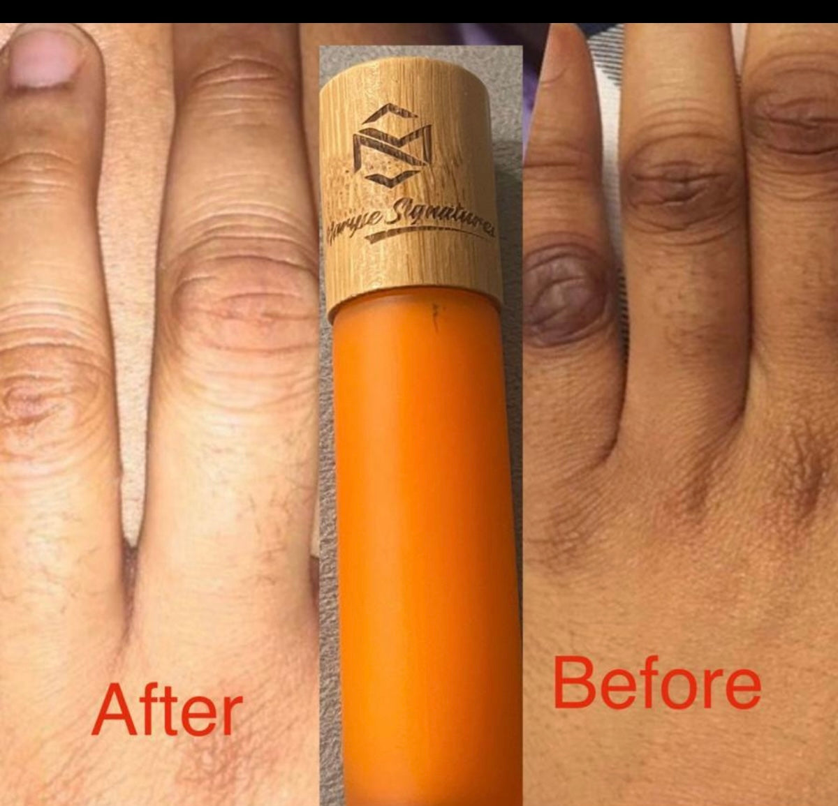 Our knuckle set provide a solution to clearing dark areas like knuckle one